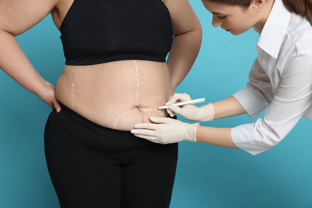Profissional de saúde realiza avaliação clínica da região abdominal e da circunferência abdominal em paciente.