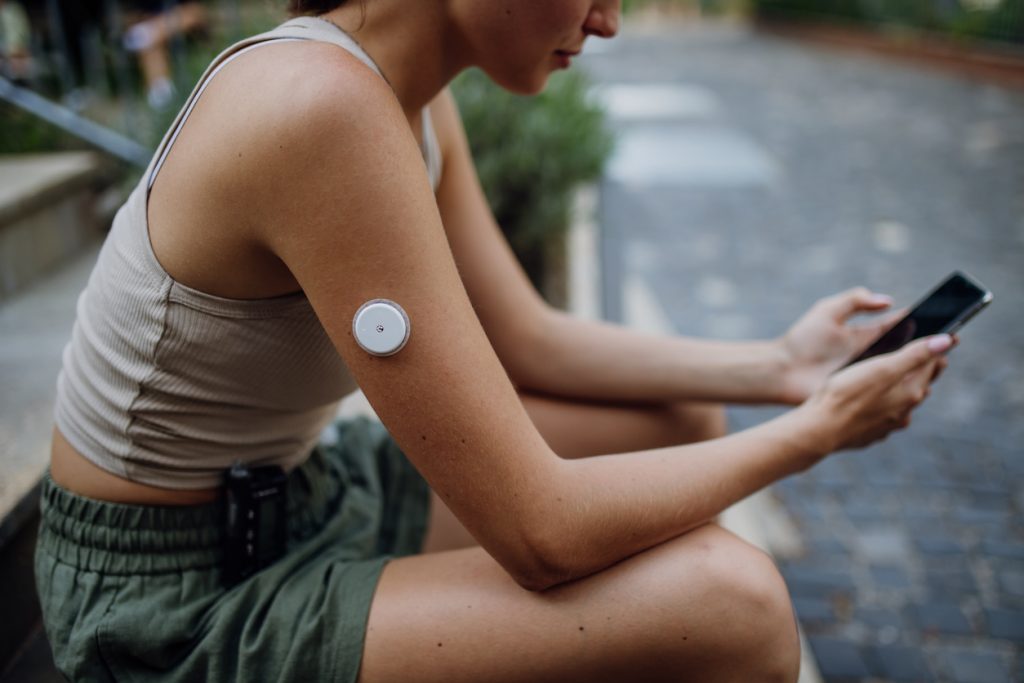 Jovem sentada ao ar livre olhando para a tela de um smartphone. Ela possui um sensor de monitoramento de glicose no braço esquerdo e um pequeno aparelho, como uma bomba de insulina, preso ao cós do seu short verde, mostrando que o tratamento vai além da dieta para diabetes e envolve tecnologia e estilo de vida.